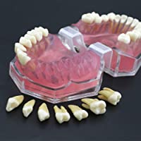 Completa Dental Modelo con los Dientes 28pcs extraíbles y Suave de Las encías estándar para la Enfermedad Tipodonto…